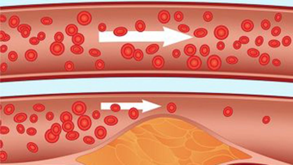 4 مشاكل صحية قد تشير إليها علامات الجوارب!